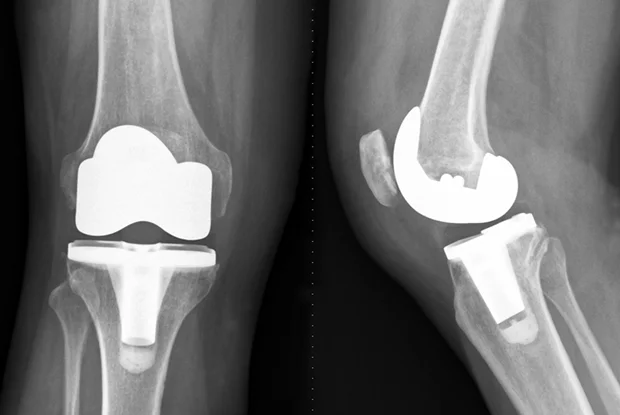 ND Mount Orthopaedic Care