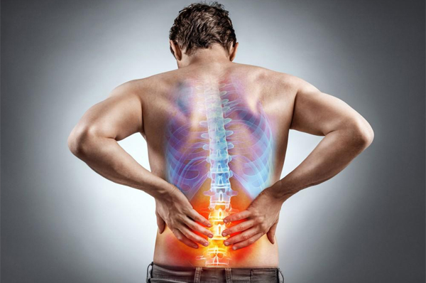 Back Pain