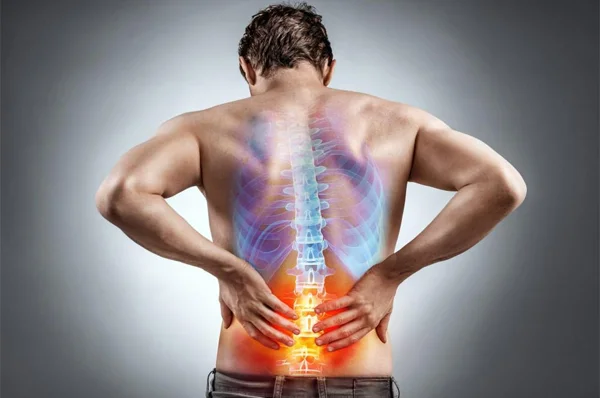 Back Pain