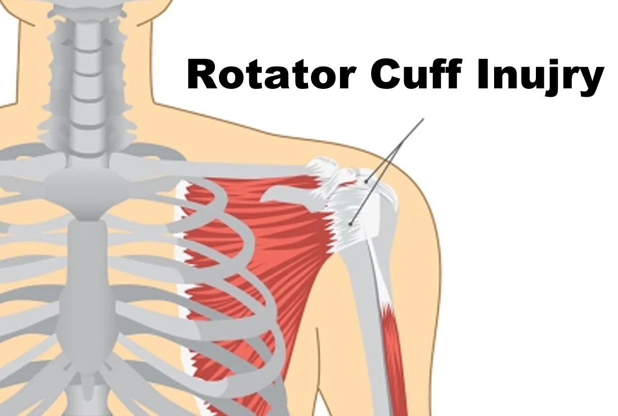  Rotator Cuff