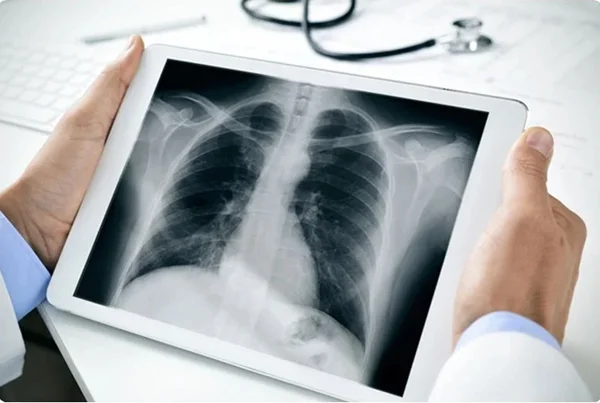 Real Digital Radiography